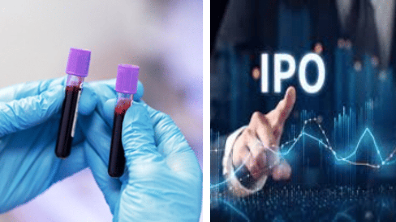 Suraksha Diagnostic का IPO 29 नवंबर को खुलेगा, जानें प्राइस बैंड और सारी डिटेल्स Suraksha Diagnostic का IPO 29 नवंबर को खुलेगा, जानें प्राइस बैंड और सारी डिटेल्स