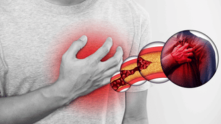 बाहर से फिट, भीतर से खतरा… AIIMS रिपोर्ट में खुलासा, 45 साल से कम उम्र में अचानक मौतों की वजह दिल की बीमारी